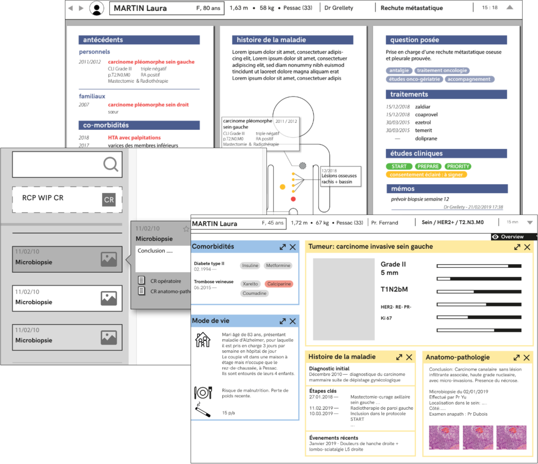 Mypl's wireframes composition